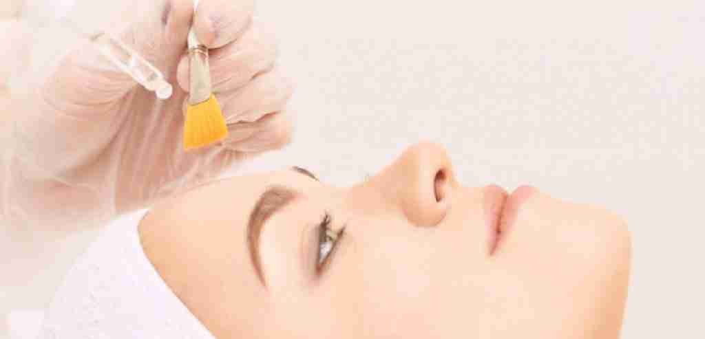 Chemical Peels